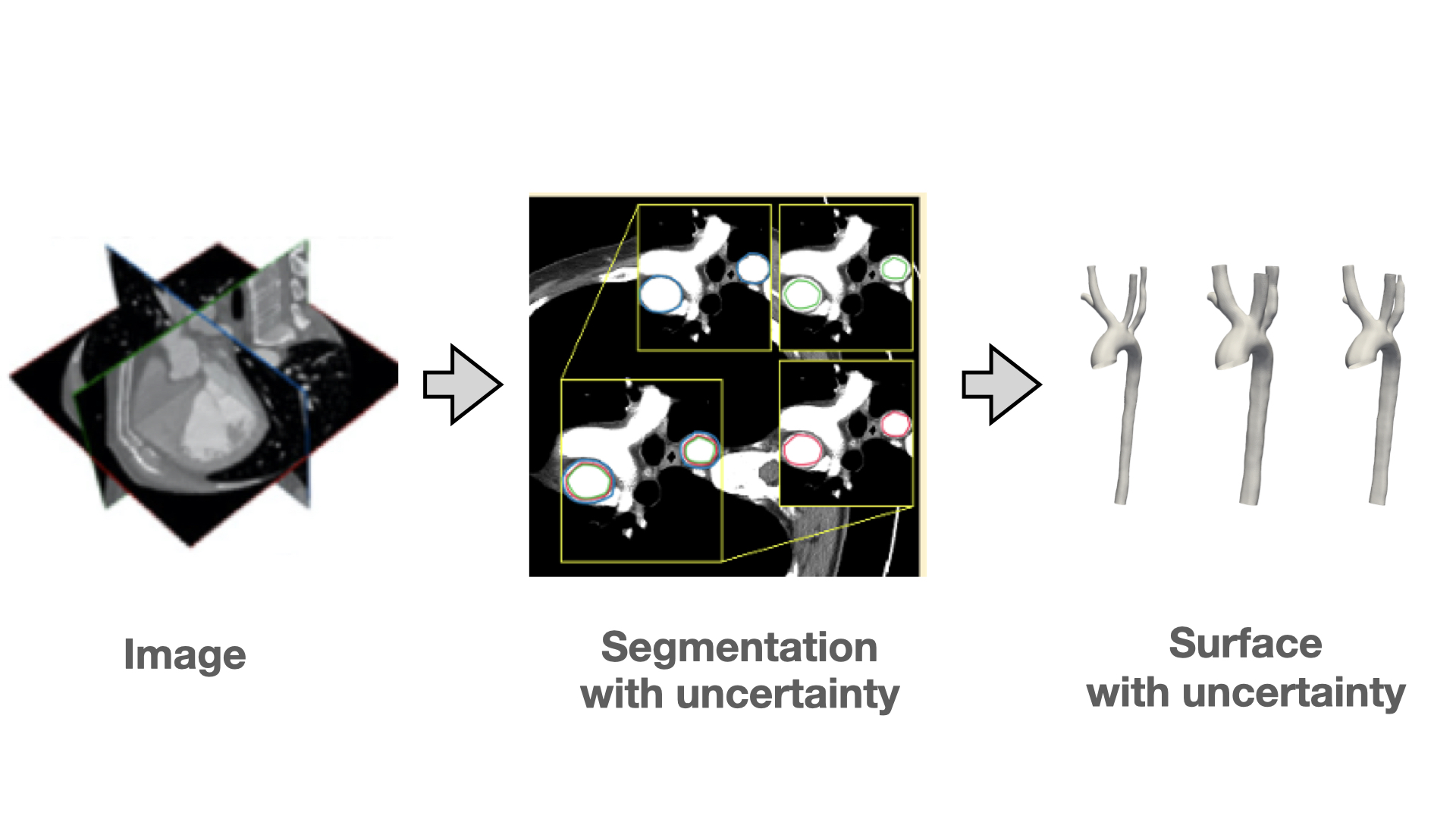 Medical image segmentation pipeline