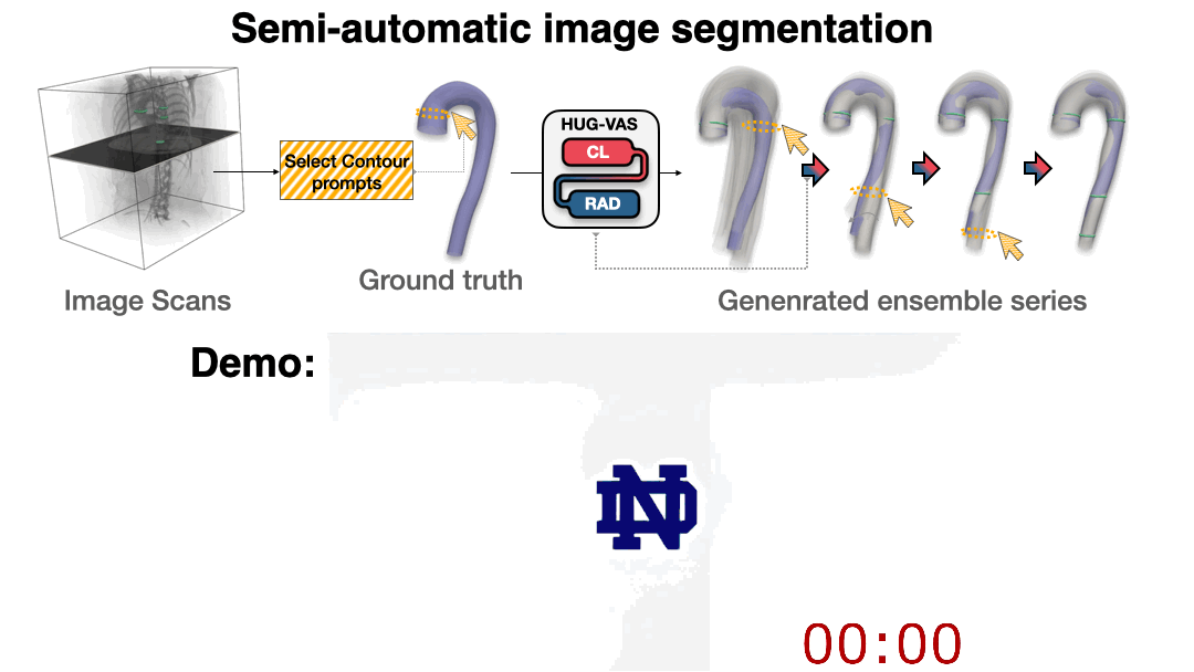 Semi-automatic medical image segmentation workflow